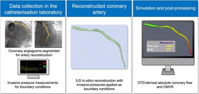 Sex differences in coronary microvascular resistance measured by a computational fluid dynamics model